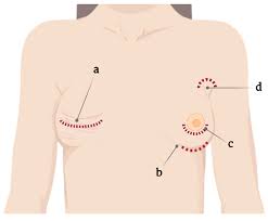 DR_JAMES_BREAST_GEL_MADE_IN_THAILAND_ml_28